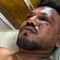 प्रमुख प्रशासकीय अधिकृतविरुद्ध चार करोडको भ्रष्टाचार मुद्दा