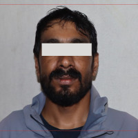 पाँच जिल्लाका २७ जनामा हैजा पुष्टि