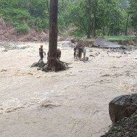 नर्भिकमा दुवै घुँडाको सफल ‘प्रतिस्थापन शल्यक्रिया’