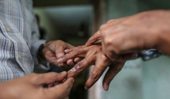राप्ती आँखा अस्पतालमा कर्नियल फोटोग्राफी मेसिन
