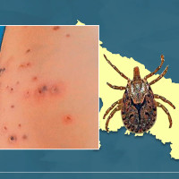 मतदाता बाेकेकाे बस दुर्घटना हुँदा ३० जना घाइते