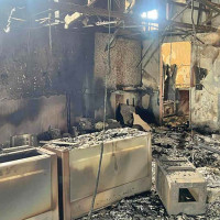 एमआरआई मेसिन सञ्चालन