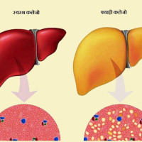 छ  घण्टापछि तुइनखोलाको पहिरो खुल्यो