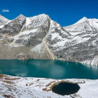 अपाङ्गता भएका व्यक्तिद्वारा अपमानित शब्द हटाउन माग