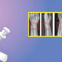 पूर्वसैनिक घलेको लोभलाग्दो ‘ड्रागन फ्रुट’ खेती