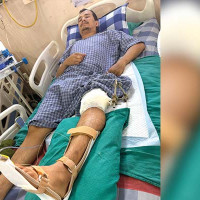 निःशुल्क उपचार घोषणा कार्यान्वयनमा आलटाल