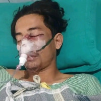 बेलौरीमा खेलाडीमाथि कुटपिट