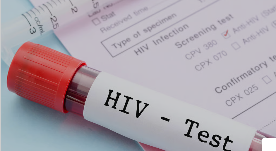 ८० जना नयाँ एचआइभी सङ्क्रमित थपिए