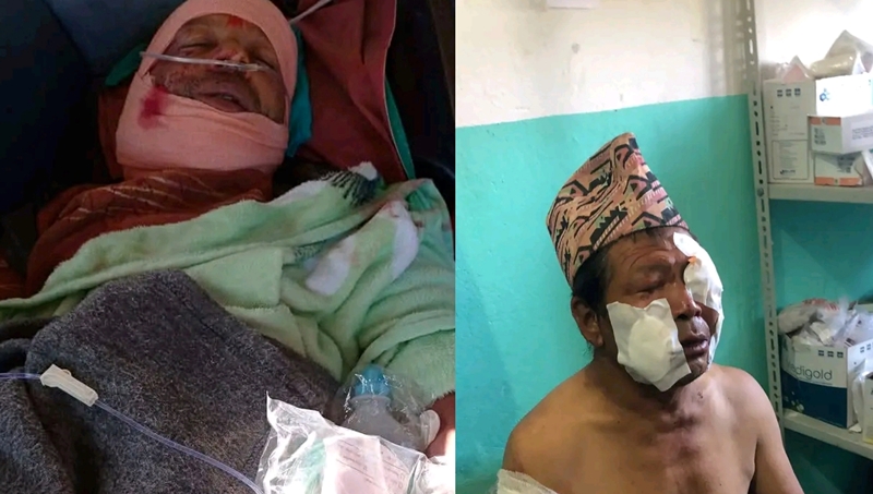 भालुको आक्रमणबाट दुई जना गम्भीर घाइते