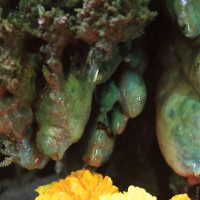 क्यान्सर अस्पताल खजुरामा नयाँ सिटी स्क्यान मेसिन सञ्चालनमा