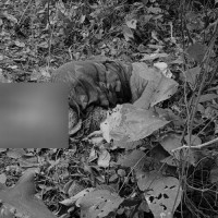 ‘आयोडिनको कमीले आइपर्छ स्वास्थ्यमा यस्तो समस्या’