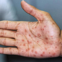 विशेष महाधिवेशन आवश्यक छ : सहमहामन्त्री मन्सुर