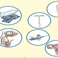 अस्थायी साधन अभाव