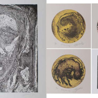 दृष्टिविहीनताले बदलिएको सपना