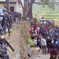 सिभिल अस्पतालमा कम्प्युटरको माध्यमबाट जोर्नी प्रत्यारोपण सेवा