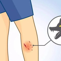 ओझेलमा सुदूरपश्चिमका पर्यटकीय सम्पदा