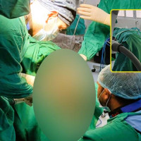 विश्वकप लिग–२ : नेपाल ओमानसँग १ विकेटले पराजित