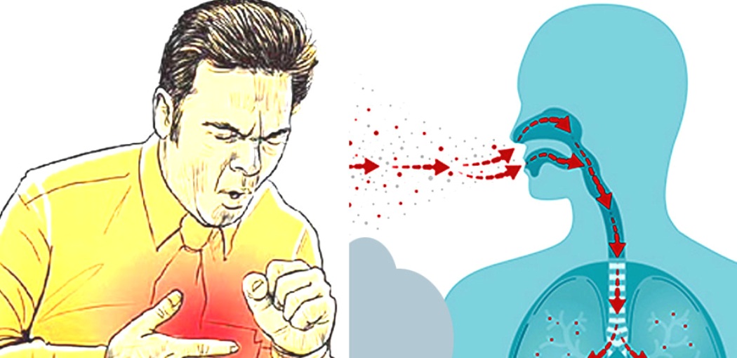 विश्वमा एक करोड सात लाखमा सक्रिय क्षयरोगी, नेपालका ४२ प्रतिशत उपचार बाहिर