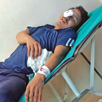 विदेशी अडिटरबाट लेखा परीक्षण गराउने कार्य रद्द