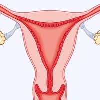 तीन दिनपछि हुम्लामा हवाई उडान सुरु