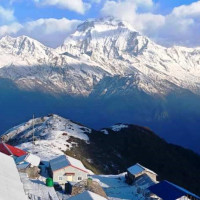 मोतिबिन्दु शल्यक्रियापछि ५२ जनाको उज्यालो फर्कियो