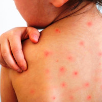 ‘कोपिलाका सुगन्ध’ बजारमा