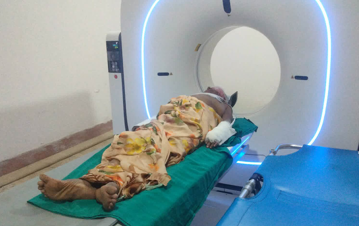 बागलुङमा अटोरिक्सा दुर्घटना हुँदा तीन  जना घाइते